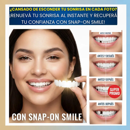 Carillas ajustables para sonrisa perfecta