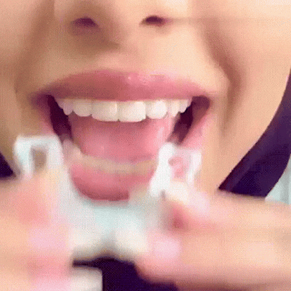 Carillas ajustables para sonrisa perfecta